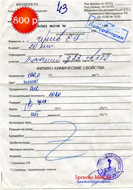 Анализ мочи общий